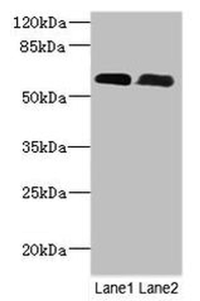 PNPLA1 Antibody in Western Blot (WB)