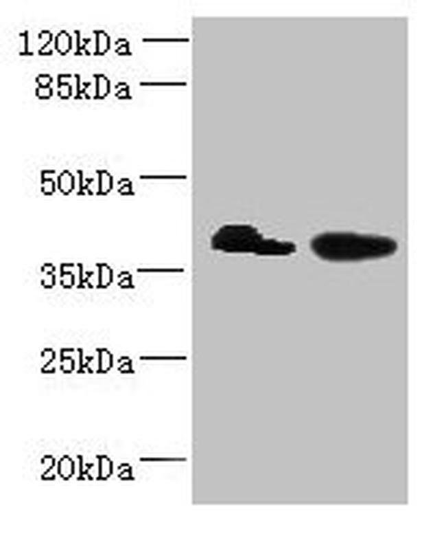 L3HYPDH Antibody in Western Blot (WB)
