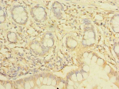 NHLRC2 Antibody in Immunohistochemistry (Paraffin) (IHC (P))