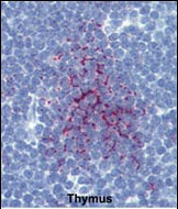 SENP1 Antibody in Immunohistochemistry (Paraffin) (IHC (P))
