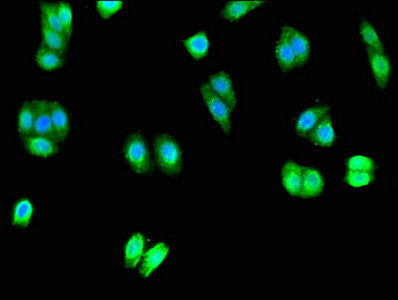 UNC80 Antibody in Immunocytochemistry (ICC/IF)