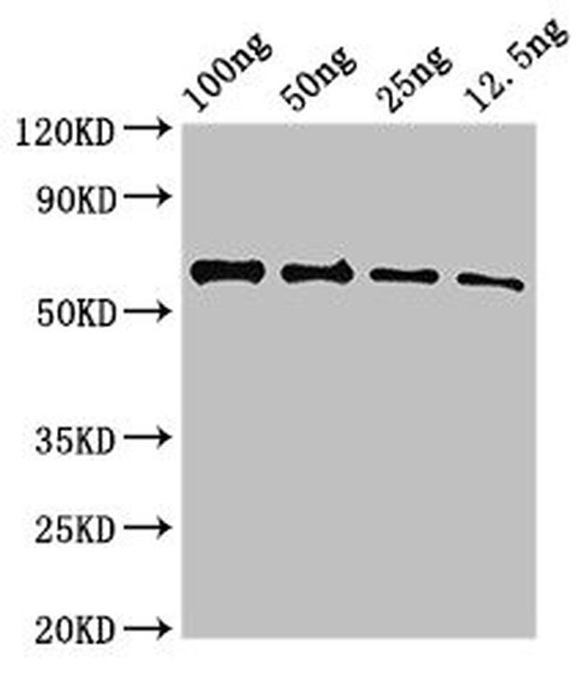 UNC80 Antibody in Western Blot (WB)