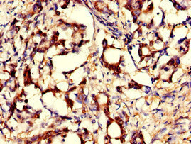 GNPNAT1 Antibody in Immunohistochemistry (Paraffin) (IHC (P))