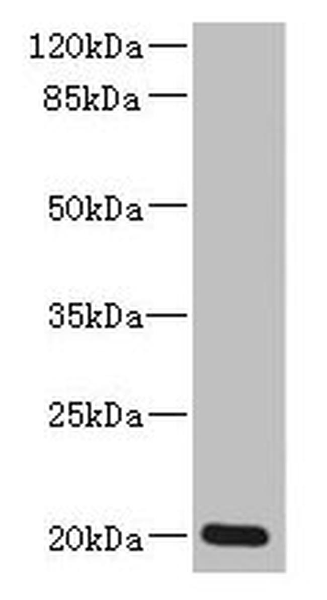 ZMAT5 Antibody in Western Blot (WB)