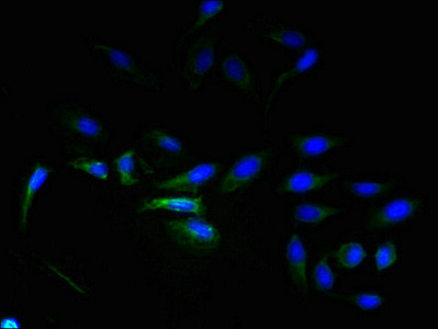 ELTD1 Antibody in Immunocytochemistry (ICC/IF)