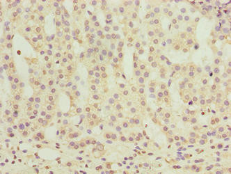 OR2H1 Antibody in Immunohistochemistry (Paraffin) (IHC (P))