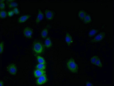 TMEM38B Antibody in Immunocytochemistry (ICC/IF)