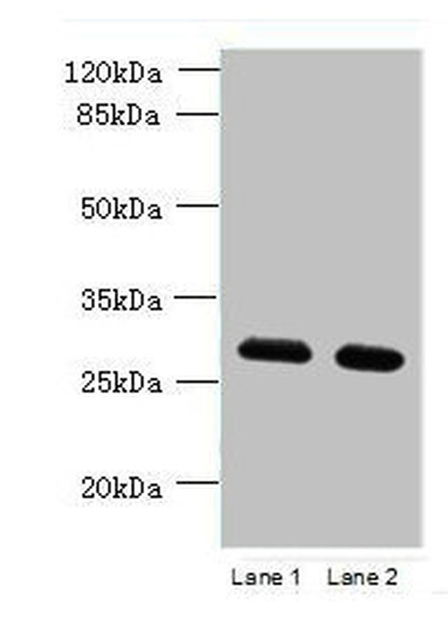 TMEM38B Antibody in Western Blot (WB)