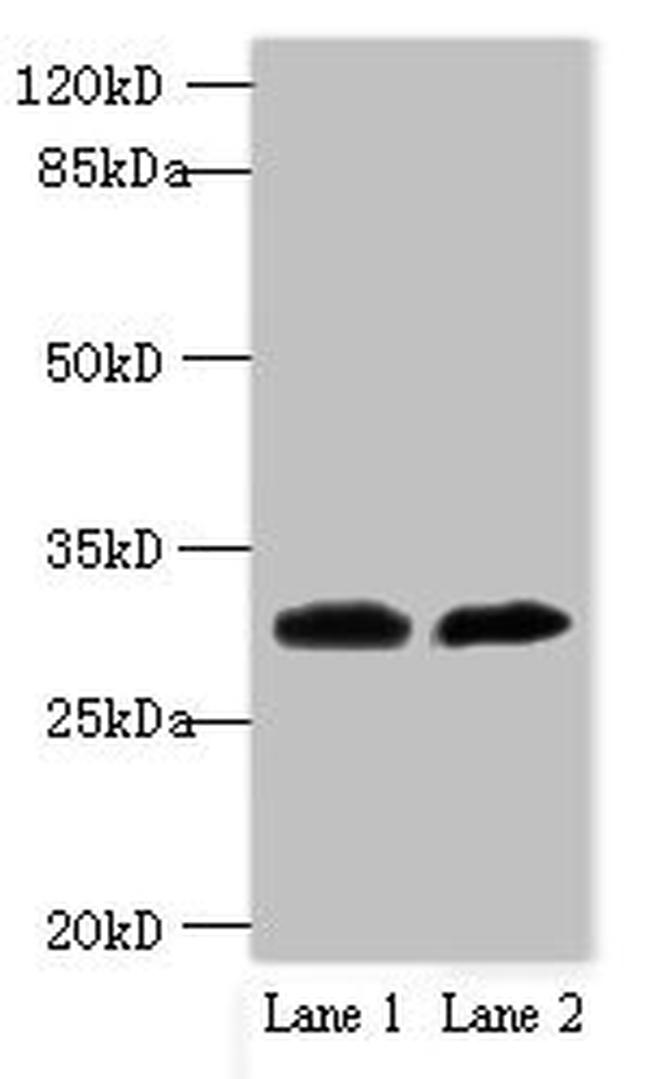 TRSPAP1 Antibody in Western Blot (WB)