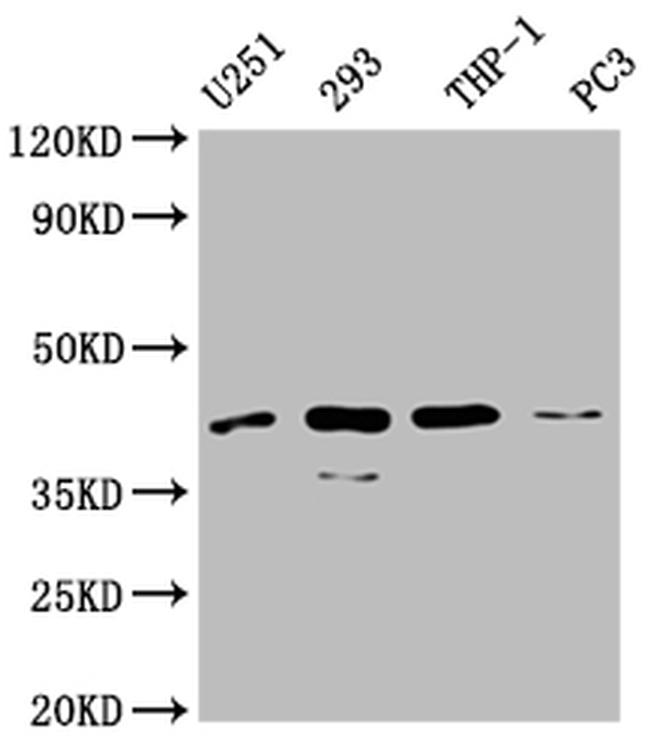 SI-CLP Antibody in Western Blot (WB)