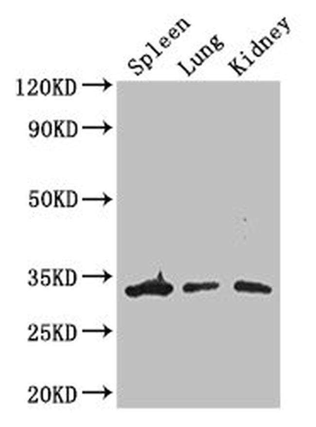 ALKBH4 Antibody in Western Blot (WB)