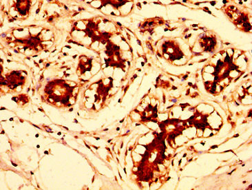 FUT8 Antibody in Immunohistochemistry (Paraffin) (IHC (P))