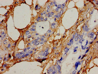 ICK Antibody in Immunohistochemistry (Paraffin) (IHC (P))