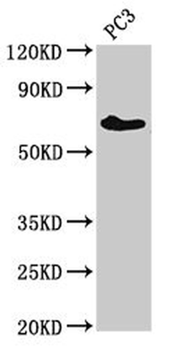 ICK Antibody in Western Blot (WB)