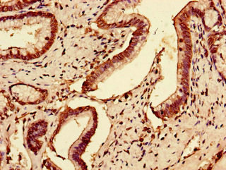 SLC7A7 Antibody in Immunohistochemistry (Paraffin) (IHC (P))