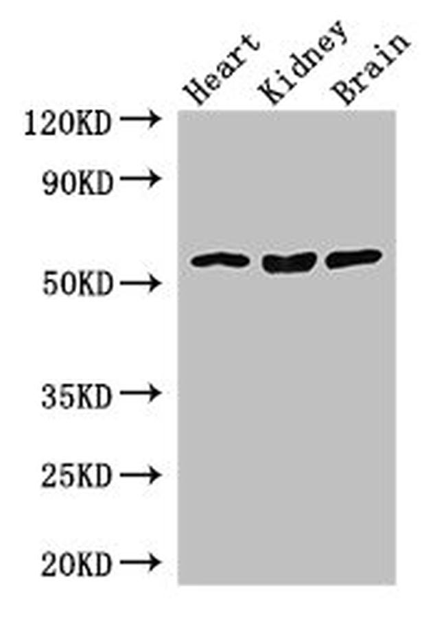 SLC7A7 Antibody in Western Blot (WB)