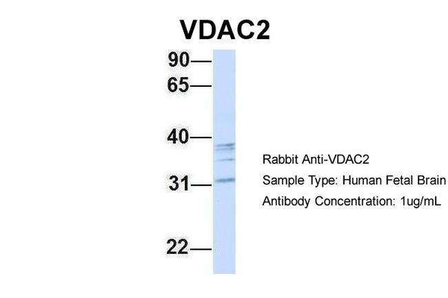 VDAC2 Antibody in Western Blot (WB)