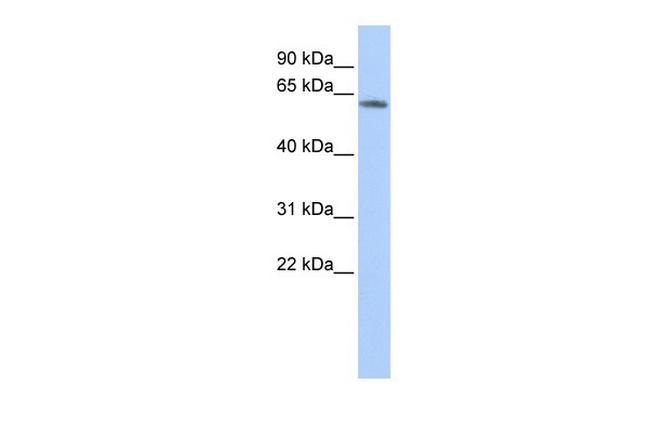 KCNG4 Antibody in Western Blot (WB)