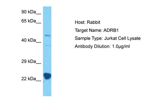 beta-1 Adrenergic Receptor Antibody in Western Blot (WB)