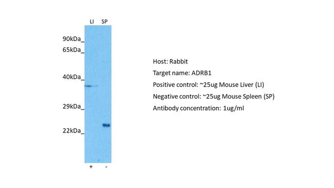 beta-1 Adrenergic Receptor Antibody in Western Blot (WB)