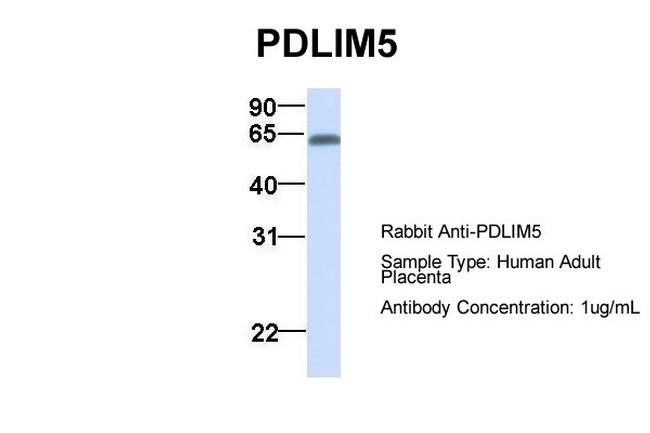 PDLIM5 Antibody in Western Blot (WB)