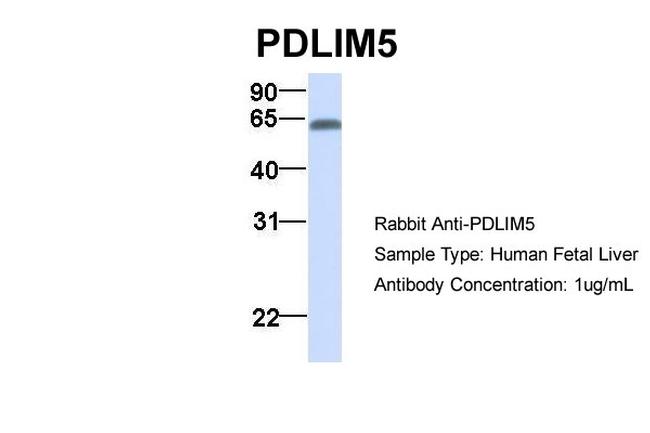 PDLIM5 Antibody in Western Blot (WB)