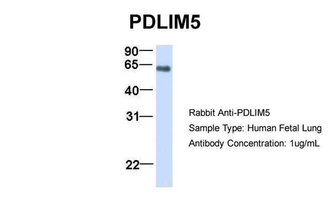 PDLIM5 Antibody in Western Blot (WB)