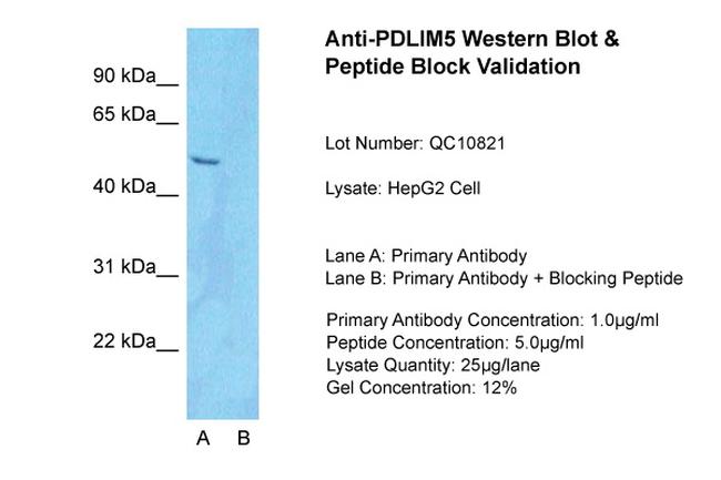 PDLIM5 Antibody in Western Blot (WB)