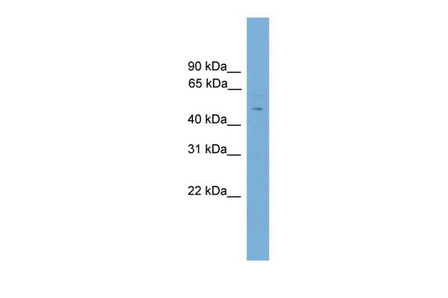 FOXC2 Antibody in Western Blot (WB)