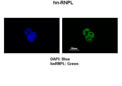 hnRNP L Antibody in Immunocytochemistry (ICC/IF)