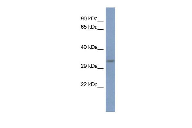 PCBP3 Antibody in Western Blot (WB)