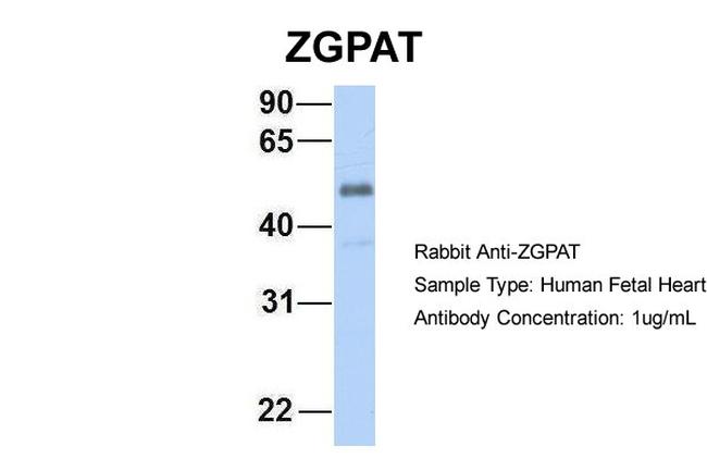 ZGPAT Antibody in Western Blot (WB)