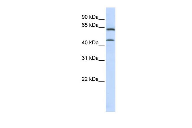 CSGALNACT1 Antibody in Western Blot (WB)