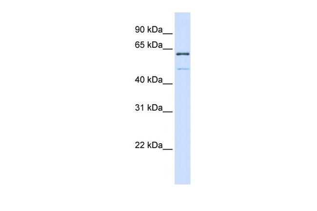 METT10D Antibody in Western Blot (WB)