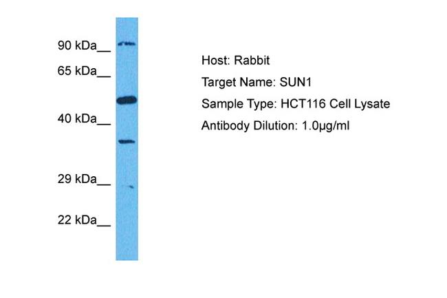 UNC84A Antibody in Western Blot (WB)