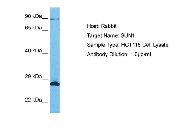 UNC84A Antibody in Western Blot (WB)