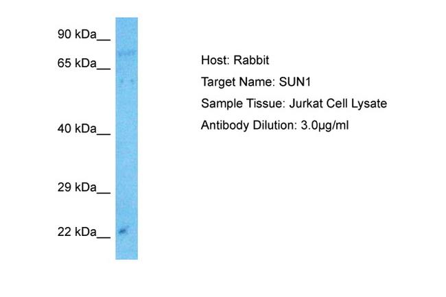 UNC84A Antibody in Western Blot (WB)