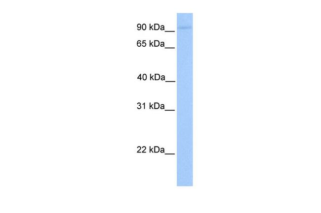 AGBL5 Antibody in Western Blot (WB)