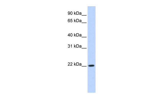 DPCD Antibody in Western Blot (WB)