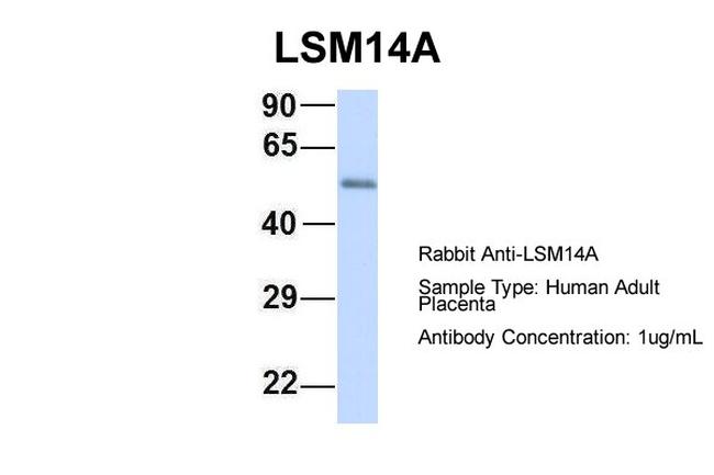 LSM14A Antibody in Western Blot (WB)