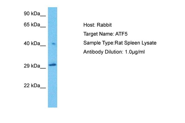 ATF5 Antibody in Western Blot (WB)