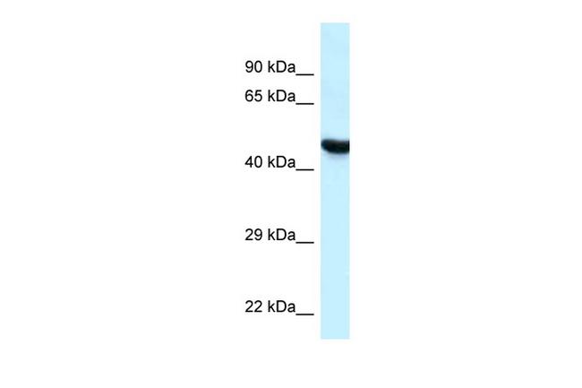 HYAL3 Antibody in Western Blot (WB)