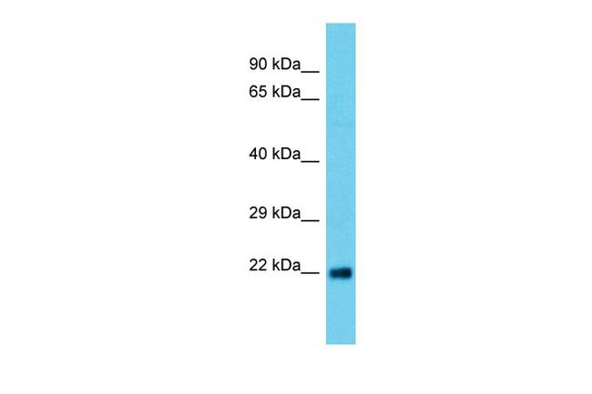 ATG101 Antibody in Western Blot (WB)