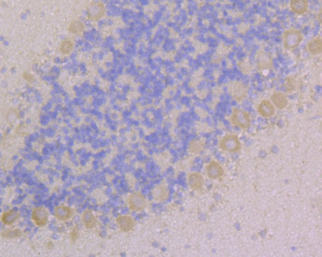 CACNG2 Antibody in Immunohistochemistry (Paraffin) (IHC (P))