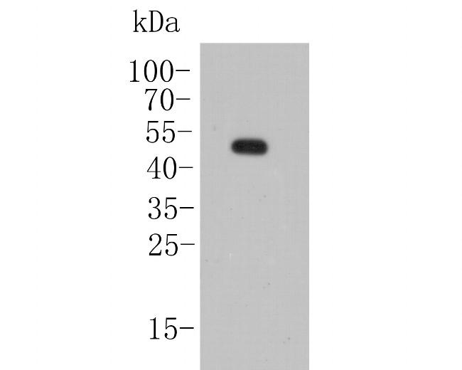 KCNK2 Antibody in Western Blot (WB)