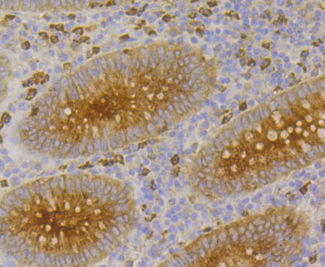 CEACAM6 Antibody in Immunohistochemistry (Paraffin) (IHC (P))