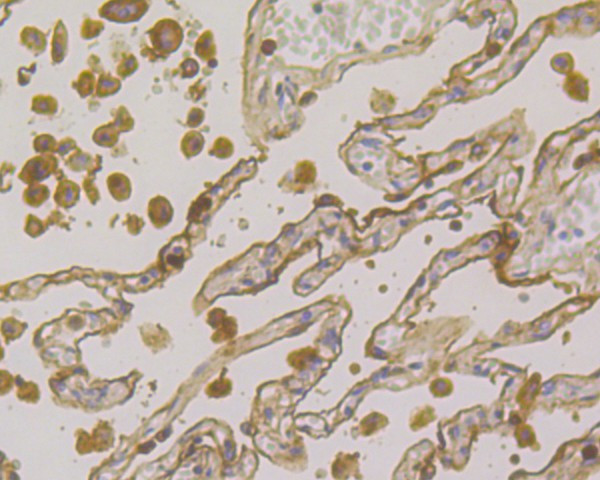 CEACAM6 Antibody in Immunohistochemistry (Paraffin) (IHC (P))