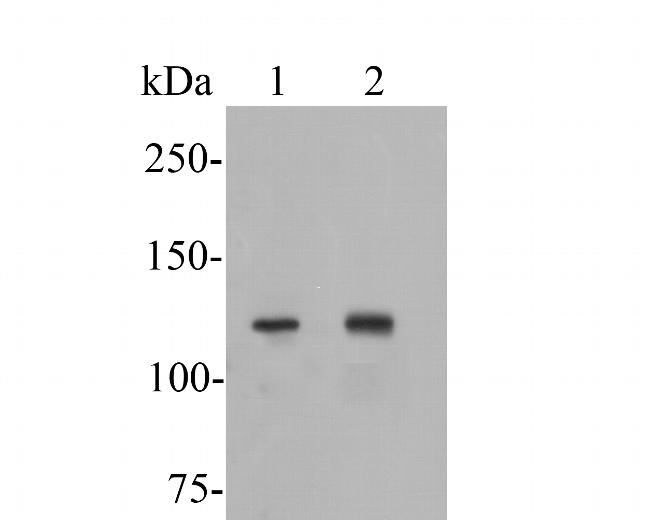 ATP8A1 Antibody in Western Blot (WB)