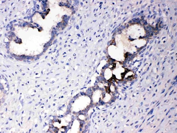 ATF6 Antibody in Immunohistochemistry (Paraffin) (IHC (P))