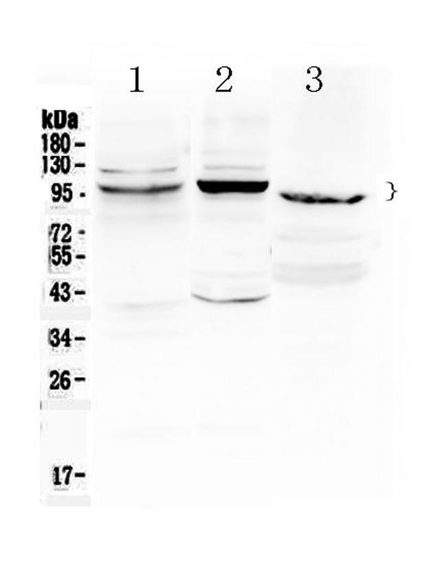 ATF6 Antibody in Western Blot (WB)